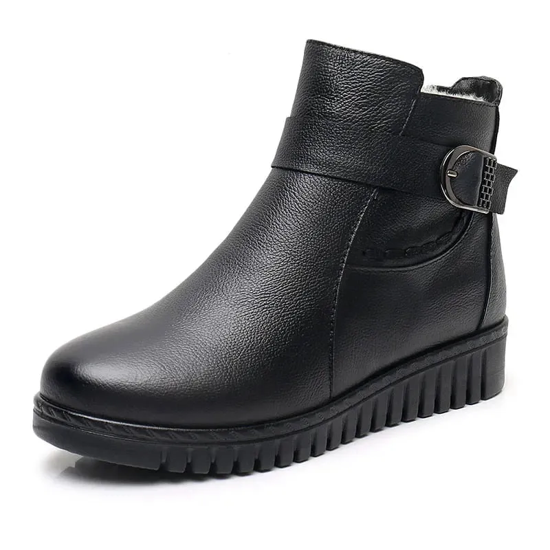 Dyavor Orthopedic Women Boot Arch Support Warm Fur AntiSlip Ankle Boots